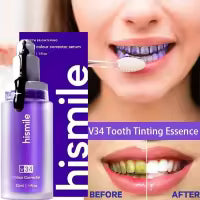 Hismile V34 Teeth Whitening Toothpaste